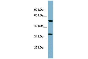 WB Suggested Anti-TMEM158 Antibody Titration:  0. (TMEM158 anticorps  (Middle Region))