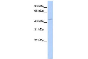 PDK1 antibody used at 1 ug/ml to detect target protein. (PDPK1 anticorps  (Middle Region))