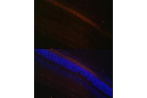 Immunofluorescence analysis of rat retina using GRK1 Polyclonal Antibody (ABIN6134352, ABIN6141414 and ABIN7101798) at dilution of 1:100 (40x lens). (GRK1 anticorps  (AA 1-160))