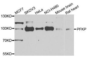 Western blot analysis of extracts of various cell lines, using PFKP antibody. (PFKP anticorps)