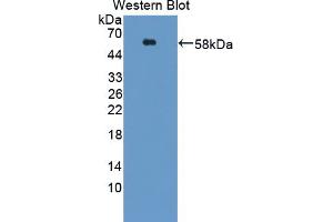 Figure. (ACVR1C/ALK7 anticorps  (AA 21-493))