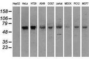 Western blot analysis of extracts (35 µg) from 9 different cell lines by using anti-SILV monoclonal antibody. (Melanoma gp100 anticorps)