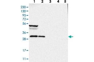 Western blot analysis of Lane 1: RT-4, Lane 2: U-251 MG, Lane 3: Human Plasma, Lane 4: Liver, Lane 5: Tonsil with SBDS polyclonal antibody  at 1:250-1:500 dilution.