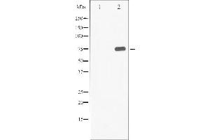 Western blot analysis of Synapsin phosphorylation expression in PMA treated 293 whole cell lysates,The lane on the left is treated with the antigen-specific peptide.