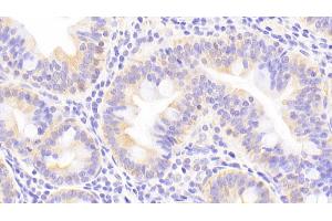 Detection of MT2 in Human Small intestine Tissue using Polyclonal Antibody to Metallothionein 2 (MT2)