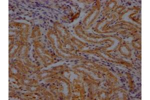 IHC image of ABIN7179061 diluted at 1:100 and staining in paraffin-embedded rat kidney tissue performed on a Leica BondTM system.