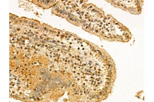 ABIN7094303 and ABIN7098350 at 1/100 staining Mouse colon tissue by IHC-P.