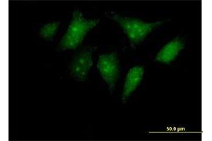 Immunofluorescence of purified MaxPab antibody to RBED1 on HeLa cell. (ELMOD3 anticorps  (AA 1-391))