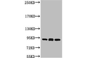 Western blot analysis of 1) Hela, 2) Mouse Brain tissue, 3) Rat Brain tissue, diluted at 1:2000.