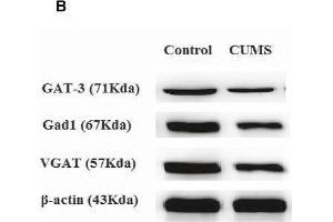 Chronic unpredictable mild stress (CUMS) exposures decrease GABAergic neuron-associated gene/protein expression level in the NAc tissue. (beta Actin anticorps)