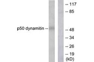 Western blot analysis of extracts from A549 cells, using p50 Dynamitin Antibody. (Dynamitin anticorps  (AA 341-390))