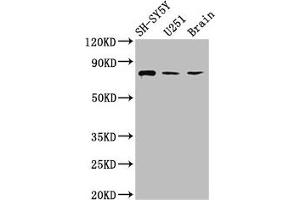 Western Blot Positive WB detected in: SH-SY5Y whole cell lysate, U251 whole cell lysate, Rat brain tissue All lanes: NCDN antibody at 2. (NCDN anticorps  (AA 403-516))