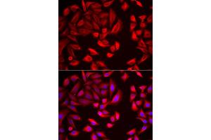 Immunofluorescence analysis of HeLa cells using CCT2 antibody (ABIN5973929). (CCT2 anticorps)