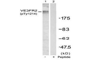 Image no. 2 for anti-VEGF Receptor 2 (VEGFR2) (pTyr1214) antibody (ABIN196768) (VEGFR2/CD309 anticorps  (pTyr1214))