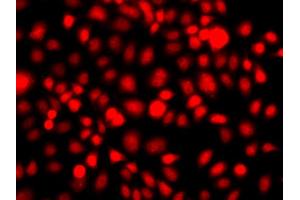 Immunofluorescence analysis of A549 cells using NR2E1 antibody (ABIN6290680). (NR2E1 anticorps)