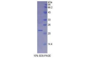 SDS-PAGE (SDS) image for Myosin Light Chain 4, Alkali, Atrial, Embryonic (MYL4) (AA 6-191) protein (His tag) (ABIN1878848)