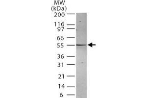 Western blot analysis for PSEN2. (Presenilin 2 anticorps)