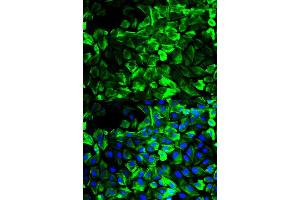 Immunofluorescence analysis of HeLa cell using TPM1 antibody. (Tropomyosin anticorps)