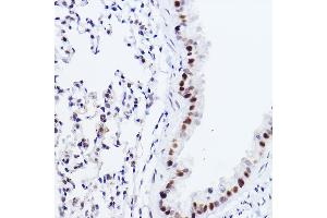 Immunohistochemistry of paraffin-embedded mouse lung using p73 Rabbit mAb (ABIN1678945, ABIN1678944, ABIN7101487 and ABIN7101488) at dilution of 1:100 (40x lens).
