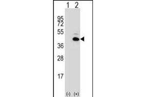 Western blot analysis of PITX1 (arrow) using rabbit polyclonal PITX1 Antibody (Center) (ABIN391506 and ABIN2841469). (PITX1 anticorps  (AA 123-150))