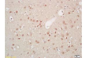 Formalin-fixed and paraffin embedded rat brain labeled with Rabbit Anti Hes5 Polyclonal Antibody, Unconjugated (ABIN703811) at 1:200 followed by conjugation to the secondary antibody and DAB staining (HES5 anticorps  (AA 21-120))