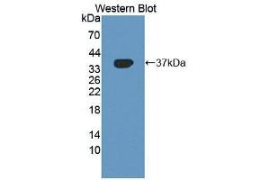 Western blot analysis of the recombinant protein. (BHMT anticorps  (AA 11-314))