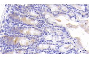 Detection of ICK in Mouse Colon Tissue using Polyclonal Antibody to Intestinal Cell Kinase (ICK) (ICK anticorps  (AA 1-284))