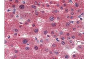 Liver, Human: Formalin-Fixed, Paraffin-Embedded (FFPE)