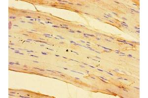 Immunohistochemistry of paraffin-embedded human skeletal muscle tissue using ABIN7170581 at dilution of 1:100
