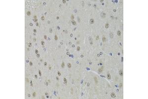 Immunohistochemistry of paraffin-embedded mouse brain using DDX1 Antibody (ABIN5973950) at dilution of 1/100 (40x lens). (DDX1 anticorps)