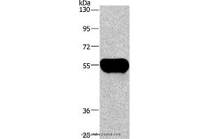 Western blot analysis of Human plasma tissue, using AHSG Polyclonal Antibody at dilution of 1:1350