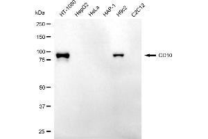 Western blotting analysis using CD10 antibody (ABIN7799368).