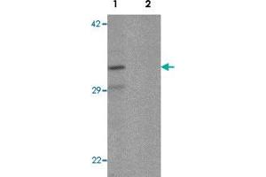 Western blot analysis of K562 cell lysate with CLEC2A polyclonal antibody  at 1 ug/mL in (1) the absence and (2) the presence of blocking peptide.
