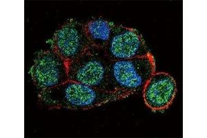 Confocal immunofluorescent analysis of VHL antibody with HepG2 cells followed by Alexa Fluor 488-conjugated goat anti-rabbit lgG (green).
