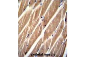 Immunohistochemistry (IHC) image for anti-Phosphatidylinositol-4-Phosphate 5-Kinase-Like 1 (PIP5KL1) antibody (ABIN2996126) (PIP5KL1 anticorps)