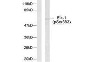 Western blot analysis of extracts from HeLa cells treated with UV, using Elk1 (Phospho-Ser383) Antibody. (ELK1 anticorps  (AA 351-400))