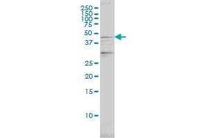 PSMC2 monoclonal antibody (M01), clone 4C10-2C8 Western Blot analysis of PSMC2 expression in SW-13 .