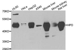 Western blot analysis of extracts of various cell lines, using HPD antibody.