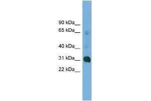 WB Suggested Anti-CCDC127 Antibody Titration: 0. (CCDC127 anticorps  (N-Term))