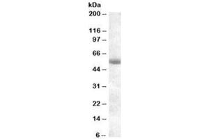 Western blot testing of human pancreas lysate with TMPRSS2 antibody at 0. (TMPRSS2 anticorps)