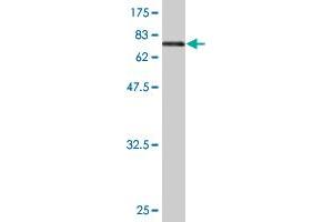 Western Blot detection against Immunogen (73. (ENO1 anticorps  (AA 1-434))