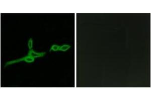Immunofluorescence analysis of LOVO cells, using GPR15 Antibody.