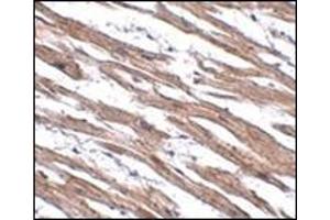 Immunohistochemistry of MAK10 in human heart tissue with this product at 2.
