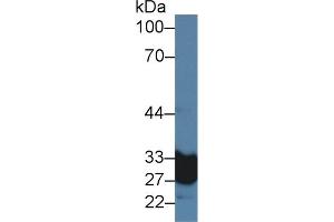 Detection of CA5A in Rat Serum using Polyclonal Antibody to Carbonic Anhydrase VA (CA5A)