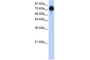 WB Suggested Anti-ZNF16 Antibody Titration:  0. (ZNF16 anticorps  (N-Term))