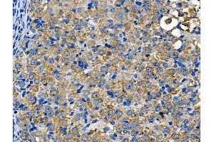ABIN6260501 and ABIN6268729 at 1/100 staining Rat ovarian tissue by IHC-P. (Cathepsin E anticorps  (Internal Region))