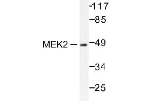 Image no. 1 for anti-Mitogen-Activated Protein Kinase Kinase 2 (MAP2K2) antibody (ABIN265519) (MEK2 anticorps)