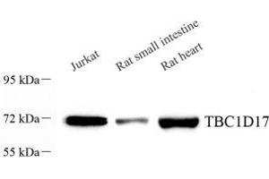Western blot analysis of TBC1D17 (ABIN7075844) at dilution of 1: 1000 (TBC1D17 anticorps)