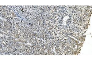 IHC analysis of eRF1/ETF1 using anti-eRF1/ETF1 antibody (ABIN7602625). (ETF1 anticorps  (AA 9-342))