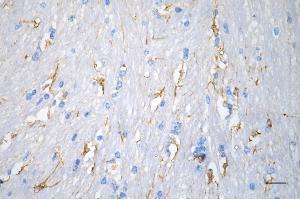 Immunohistochemistry was performed on paraffin-embedded mouse brain using desmin antibody (ABIN7798314), 1:200). (Recombinant Desmin anticorps)
